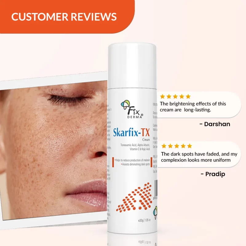 Skarfix-TX For Melasma Treatment - Image 4