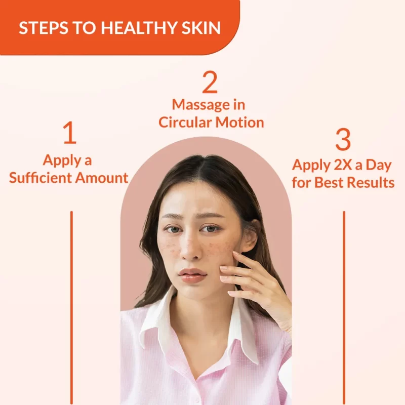 Skarfix-TX For Melasma Treatment - Image 5